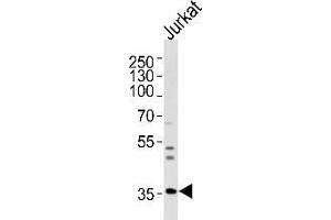 Western blot analysis of lysate from Jurkat cell line, using Glycine receptor beta Antibody (N-term) Cat. (GLRB 抗体  (N-Term))