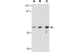 Western blot analysis of GOPC in PC-3 cell lysate with GOPC polyclonal antibody  at (A) 1, (B) 2 and (C) 4 ug/mL . (GOPC 抗体  (Internal Region))