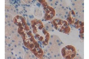 IHC-P analysis of Rat Kidney Tissue, with DAB staining. (CHI3L1 抗体  (AA 117-364))