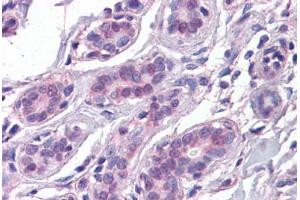 Human Breast: Formalin-Fixed, Paraffin-Embedded (FFPE) (COX17 抗体  (AA 1-64))