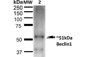 Western blot analysis of Rat Liver showing detection of ~51 kDa Beclin 1 protein using Rabbit Anti-Beclin 1 Polyclonal Antibody (ABIN2868755). (Beclin 1 抗体  (PE))