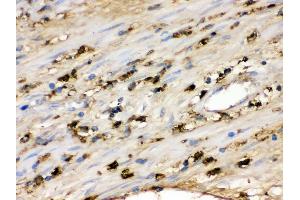 IHC(P): Human Appendicitis Tissue (S100A9 抗体  (AA 2-114))