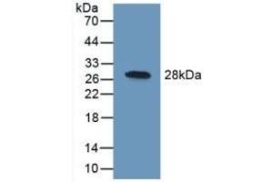 Detection of Recombinant UCHL1, Human using Polyclonal Antibody to Ubiquitin Carboxyl Terminal Hydrolase L1 (UCHL1) (UCHL1 抗体  (AA 2-223))