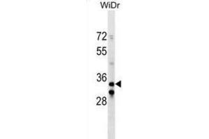 Western Blotting (WB) image for anti-Integrin beta 1 Binding Protein (Melusin) 2 (ITGB1BP2) antibody (ABIN2999936) (ITGB1BP2 抗体)
