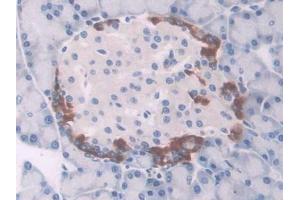 IHC-P analysis of Rat Pancreas Tissue, with DAB staining. (UCP1 抗体  (AA 179-296))