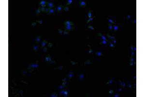 Immunofluorescence staining of A549 cells with ABIN7156172 at 1:100, counter-stained with DAPI. (RHBDF2 抗体  (AA 1-200))