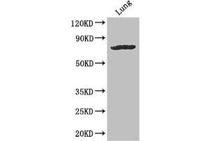 Western Blot Positive WB detected in: Mouse lung tissue All lanes: SLC28A3 antibody at 3 μg/mL Secondary Goat polyclonal to rabbit IgG at 1/50000 dilution Predicted band size: 77, 70 kDa Observed band size: 77 kDa (SLC28A3 抗体  (AA 1-102))