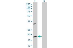 Western Blot analysis of TSC22D1 expression in transfected 293T cell line by TSC22D1 MaxPab polyclonal antibody. (TSC22D1 抗体  (AA 1-144))