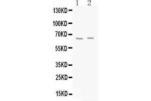 Western Blotting (WB) image for anti-Glutamate Decarboxylase 2 (Pancreatic Islets and Brain, 65kDa) (GAD2) (AA 131-164), (N-Term) antibody (ABIN5518755)