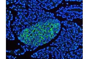 IF analysis of SYP using anti-SYP antibody (ABIN3042768). (Synaptophysin 抗体  (N-Term))