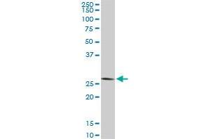 Western Blotting (WB) image for anti-CCR4-NOT Transcription Complex, Subunit 7 (CNOT7) (AA 1-285) antibody (ABIN565426)