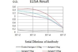 Black line: Control Antigen (100 ng),Purple line: Antigen (10 ng), Blue line: Antigen (50 ng), Red line:Antigen (100 ng) (Cytokeratin 18 抗体  (AA 1-150))