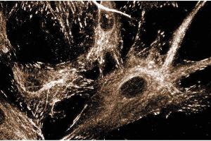 Immunofluoresence staining of human fibroblasts. (Paxillin 抗体  (AA 1-557))