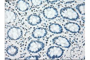 Immunohistochemical staining of paraffin-embedded pancreas tissue using anti-CHEK2mouse monoclonal antibody. (CHEK2 抗体)