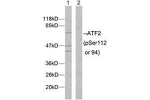 Western blot analysis of extracts from MDA-MB-435 cells, using ATF2 (Phospho-Ser112 or 94) Antibody. (ATF2 抗体  (pSer112))