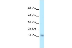 WB Suggested Anti-Nme1 Antibody Titration: 1. (NME1 抗体  (C-Term))