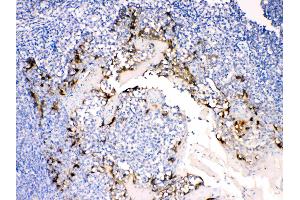 Anterior Gradient 2 was detected in paraffin-embedded sections of  human tonsil tissues using rabbit anti- Anterior Gradient 2 Antigen Affinity purified polyclonal antibody (Catalog # ) at 1 µg/mL. (AGR2 抗体  (AA 21-175))