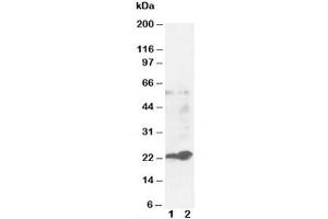 Western blot testing of GST pi antibody and Lane 1:  MCF-7 (Glutathione S Transferases pi 抗体)