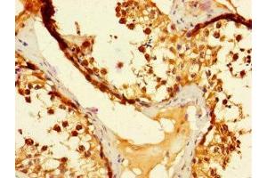 Immunohistochemistry of paraffin-embedded human testis tissue using ABIN7173524 at dilution of 1:100 (DUS3L 抗体  (AA 221-409))