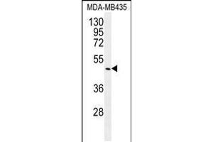 Western blot analysis in MDA-MB435 cell line lysates (35ug/lane). (GDF5 抗体  (C-Term))
