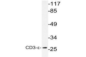 Western blot (WB) analysis of CD3-epsilon antibody in extracts from K562 cells. (CD3 抗体)