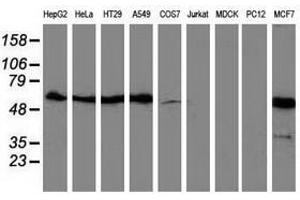 Image no. 2 for anti-Sequestosome 1 (SQSTM1) antibody (ABIN1499989) (SQSTM1 抗体)