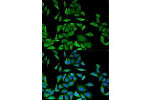 Immunofluorescence analysis of MCF-7 cells using DBI antibody. (Diazepam Binding Inhibitor 抗体)