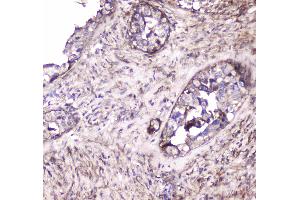 Immunohistochemistry (IHC) image for anti-S100 Calcium Binding Protein A10 (S100A10) (AA 4-94) antibody (ABIN5692833)