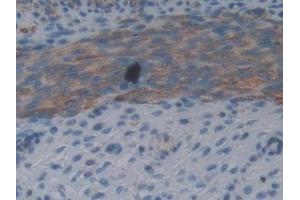Detection of FIL1d in Mouse Uterus Tissue using Polyclonal Antibody to Interleukin 1 Delta (FIL1d) (FIL1d 抗体  (AA 1-156))