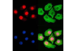 Phospho-MCM2 (Ser41) Antibody staining Hela cells by IF/ICC.
