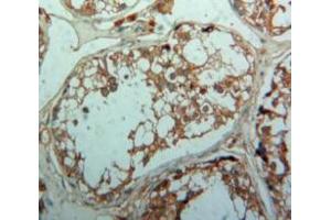 Used in DAB staining on fromalin fixed paraffin-embedded Testis tissue (TGFBR1 抗体  (AA 162-403))