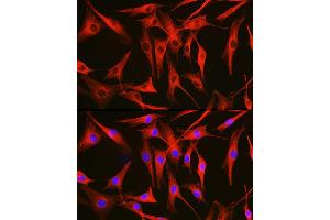 anti-Tubulin, alpha 1B (TUBA1B) (AA 1-451) antibody