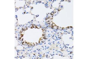 Immunohistochemistry of paraffin-embedded rat lung using N antibody (ABIN6129932, ABIN6144318, ABIN6144319 and ABIN6222781) at dilution of 1:100 (40x lens). (NAA10 抗体  (AA 161-235))