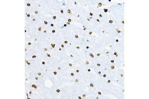 Immunohistochemistry of paraffin-embedded rat brain using SOX10 Rabbit pAb (ABIN7270568) at dilution of 1:100 (40x lens). (SOX10 抗体  (AA 200-300))