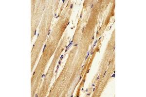 (ABIN6242157 and ABIN6578316) staining Zebrafish ak2 in zebra fish body tissue sections by Immunohistochemistry (IHC-P - paraformaldehyde-fixed, paraffin-embedded sections). (Adenylate Kinase 2 抗体  (N-Term))