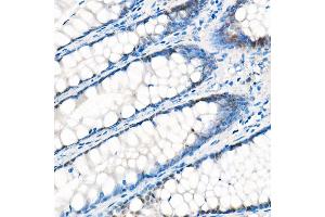 Immunohistochemistry of paraffin-embedded Human liver (negative control sample) using Y antibody (ABIN7271418) at dilution of 1:1000 (40x lens). (YAP1 抗体)