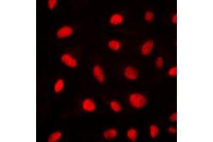 Immunofluorescent analysis of ELK1 staining in NIH3T3 cells. (ELK1 抗体  (N-Term))