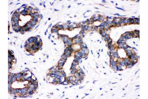Immunohistochemistry (Paraffin-embedded Sections) (IHC (p)) image for anti-Cell Division Cycle 6 Homolog (S. Cerevisiae) (CDC6) (AA 147-549) antibody (ABIN3043500) (CDC6 抗体  (AA 147-549))