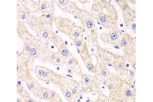 Immunohistochemistry of paraffin-embedded Human liver damage using PSMF1 Polyclonal Antibody at dilution of 1:100 (40x lens). (PSMF1 抗体)