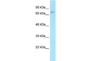 WB Suggested Anti-HAUS3 Antibody Titration: 1. (HAUS3 抗体  (Middle Region))