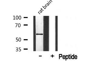 Western blot analysis of Cytochrome P450 1A2 Antibody expression in rat brain tissue lysates. (CYP1A2 抗体  (Internal Region))