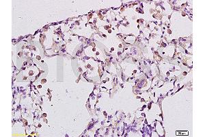 Immunohistochemistry (IHC) image for anti-Leukotriene B4 Receptor (LTB4R) (AA 101-200) antibody (ABIN748628)