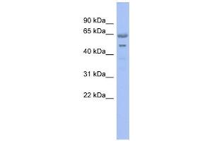 GNL3 antibody used at 1 ug/ml to detect target protein. (Nucleostemin 抗体)