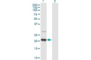 Western Blot analysis of RAX2 expression in transfected 293T cell line by RAX2 MaxPab polyclonal antibody. (RAX2 抗体  (AA 1-184))