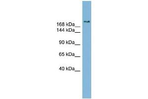 WB Suggested Anti-SETBP1 Antibody Titration:  0. (SETBP1 抗体  (Middle Region))