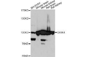 Western blot analysis of extracts of various cell lines, using GRIK4 antibody. (GRIK4 抗体)