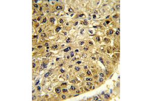 Immunohistochemistry (IHC) image for anti-Dopachrome Tautomerase (DCT) antibody (ABIN3003902) (DCT 抗体)