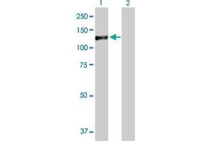 Western Blot analysis of GTF3C2 expression in transfected 293T cell line by GTF3C2 MaxPab polyclonal antibody. (GTF3C2 抗体  (AA 1-911))