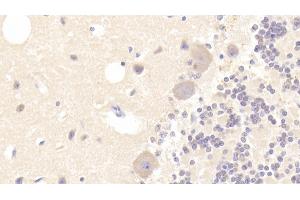 Detection of TUBa3C in Human Cerebellum Tissue using Polyclonal Antibody to Tubulin Alpha 3C (TUBa3C) (TUBA3C 抗体  (AA 1-300))