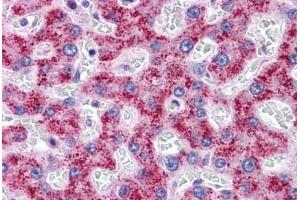 Human Liver: Formalin-Fixed, Paraffin-Embedded (FFPE) (SYPL1 抗体  (N-Term))